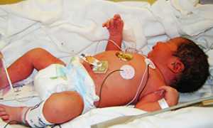 corta punto nascite bebe culla