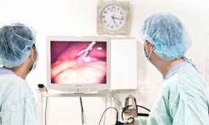 operazione